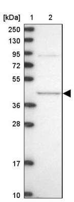 Western Blot: MVD Antibody [NBP2-13628]