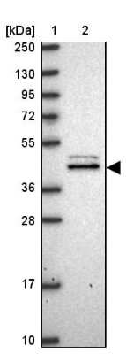 Western Blot: MVD Antibody [NBP2-13629]