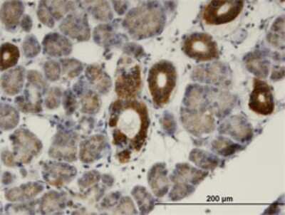 Immunohistochemistry-Paraffin: MVK Antibody (2C5) [H00004598-M02]