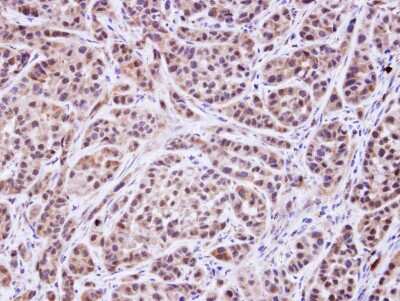 Immunohistochemistry-Paraffin: MVK Antibody [NBP1-32868]