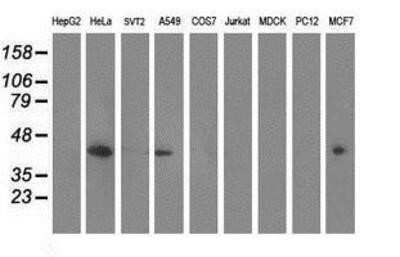 Western Blot: MVK Antibody (OTI 1D7)Azide and BSA Free [NBP2-72837]