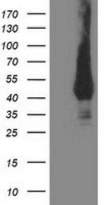 Western Blot: MVK Antibody (OTI 1D7)Azide and BSA Free [NBP2-72837]