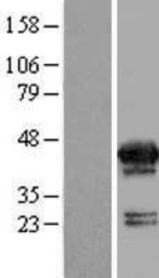 Western Blot: MVK Overexpression Lysate [NBP2-09397]