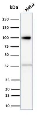 Western Blot: MVP Antibody (1014) [NBP2-44400]