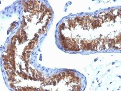 Immunohistochemistry-Paraffin: MVP Antibody (1032) - Azide and BSA Free [NBP2-47807]