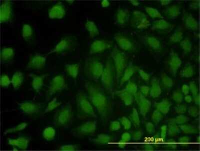 Immunocytochemistry/ Immunofluorescence: MVP Antibody (2H3-1A6) [H00009961-M01]