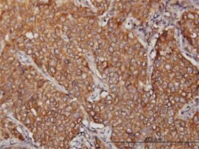 Immunohistochemistry-Paraffin: MVP Antibody (2H3-1A6) [H00009961-M01]