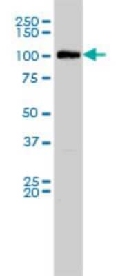 Western Blot: MVP Antibody (2H3-1A6) [H00009961-M01]
