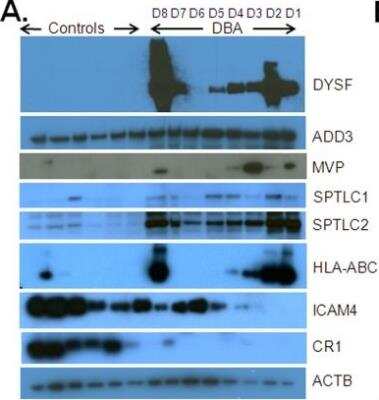 Western Blot: MVP Antibody (2H3-1A6) [H00009961-M01]