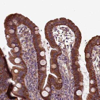 Immunohistochemistry: MVP Antibody [NBP2-56408]