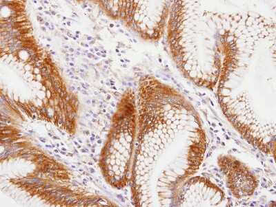 Immunohistochemistry-Paraffin: MVP Antibody [NBP1-31295]