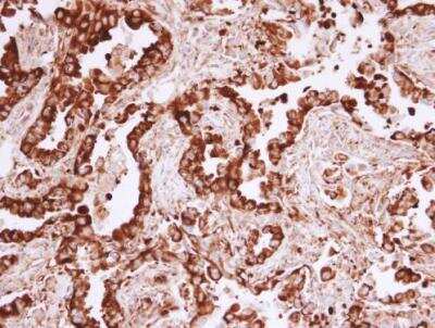 Immunohistochemistry-Paraffin: MVP Antibody [NBP1-33560]