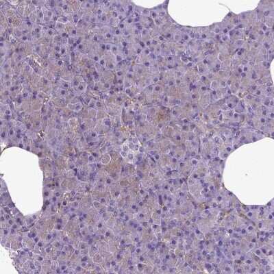 Immunohistochemistry-Paraffin: MVP Antibody [NBP2-56408]
