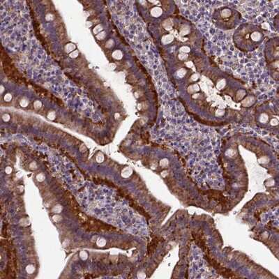 Immunohistochemistry-Paraffin: MVP Antibody [NBP2-56408]