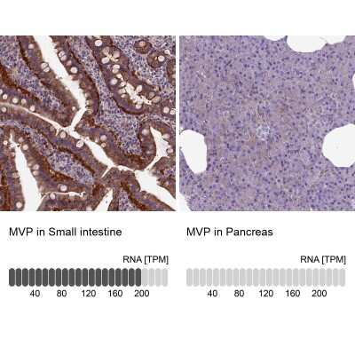 Immunohistochemistry-Paraffin: MVP Antibody [NBP2-56408]