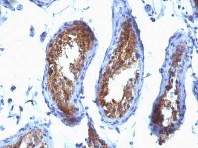 Immunohistochemistry-Paraffin: MVP Antibody (SPM280) - IHC-Prediluted [NBP2-48434]