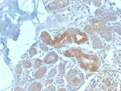 Immunohistochemistry-Paraffin: MVP Antibody (VP2897R) - Azide and BSA Free [NBP3-08801]