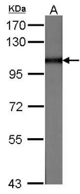 Western Blot: MVP Antibody [NBP1-31295]