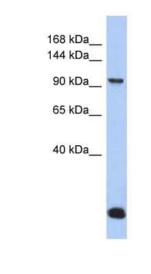 Western Blot: MVP Antibody [NBP1-52931]