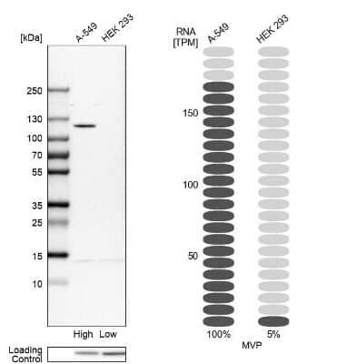 Western Blot: MVP Antibody [NBP1-82820]