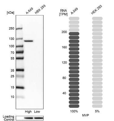 Western Blot: MVP Antibody [NBP2-56408]