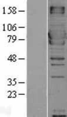 Western Blot: MxA/Mx1 Overexpression Lysate [NBL1-13404]