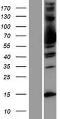 Western Blot: MxA/Mx1 Overexpression Lysate [NBP2-09716]