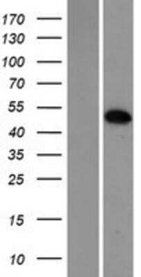 Western Blot: Mxi1 Overexpression Lysate [NBP2-05743]