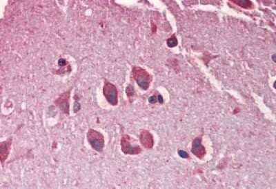 Immunohistochemistry-Paraffin: MXRA5 Antibody [NBP1-46122]