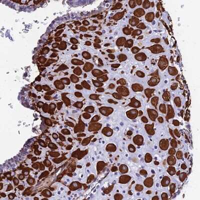 Immunohistochemistry-Paraffin: MXRA7 Antibody [NBP1-93731]