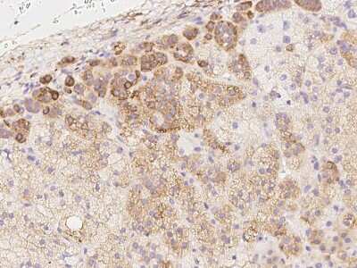 Immunohistochemistry-Paraffin: MXRA7 Antibody [NBP3-06326]