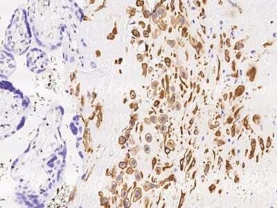 Immunohistochemistry-Paraffin: MXRA7 Antibody [NBP3-06326]