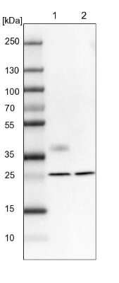 Western Blot: MXRA7 Antibody [NBP1-93731]