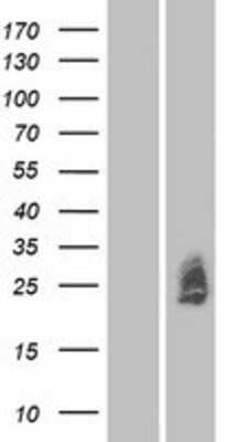 Western Blot: MXRA7 Overexpression Lysate [NBP2-08810]