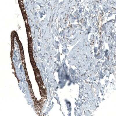 Immunohistochemistry-Paraffin: MXRA8/DICAM Antibody [NBP2-30993]