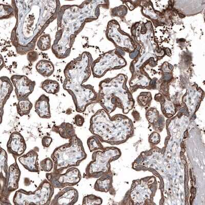 Immunohistochemistry-Paraffin: MXRA8/DICAM Antibody [NBP2-30993]