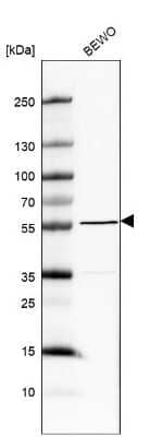 Western Blot: MXRA8/DICAM Antibody [NBP2-30993]