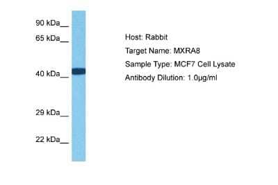 Western Blot: MXRA8/DICAM Antibody [NBP2-83239]