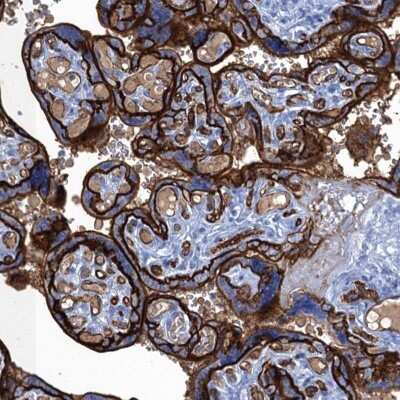 Immunohistochemistry: MYADML2 Antibody [NBP2-32600]