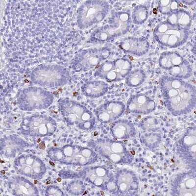 Immunohistochemistry-Paraffin: MYADML2 Antibody [NBP2-33526]