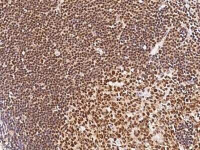 Immunohistochemistry-Paraffin: MYB Antibody [NBP2-98885]