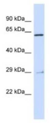 Western Blot: MYB Antibody [NBP3-10483]