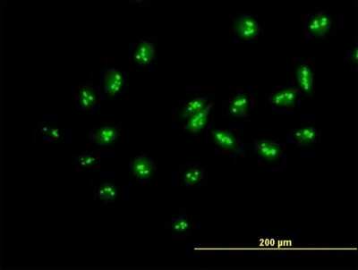 Immunocytochemistry/ Immunofluorescence: MYBBP1A Antibody [H00010514-B01P]