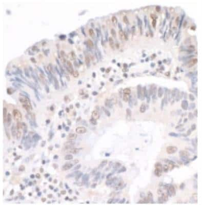 Immunohistochemistry-Paraffin: MYBBP1A Antibody [NB100-61050]