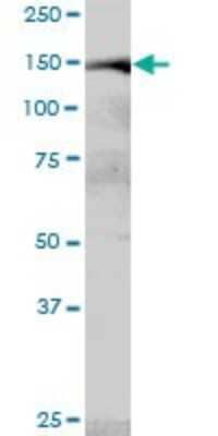 Western Blot: MYBBP1A Antibody [H00010514-B01P]