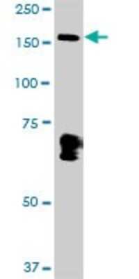 Western Blot: MYBBP1A Antibody [H00010514-D01P]