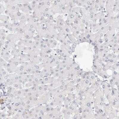 Immunohistochemistry-Paraffin: MYBPC1 Antibody [NBP1-86385]