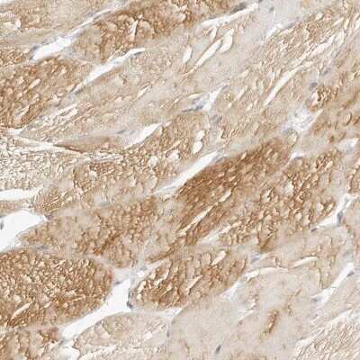 Immunohistochemistry-Paraffin: MYBPC1 Antibody [NBP1-86385]