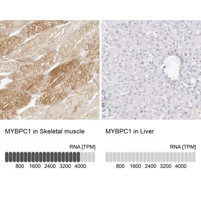 Immunohistochemistry-Paraffin: MYBPC1 Antibody [NBP1-86385]