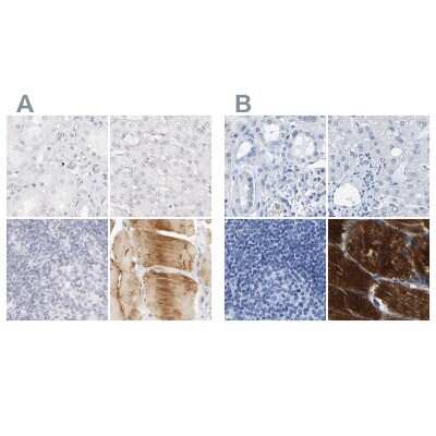 Immunohistochemistry-Paraffin: MYBPC1 Antibody [NBP1-86385]